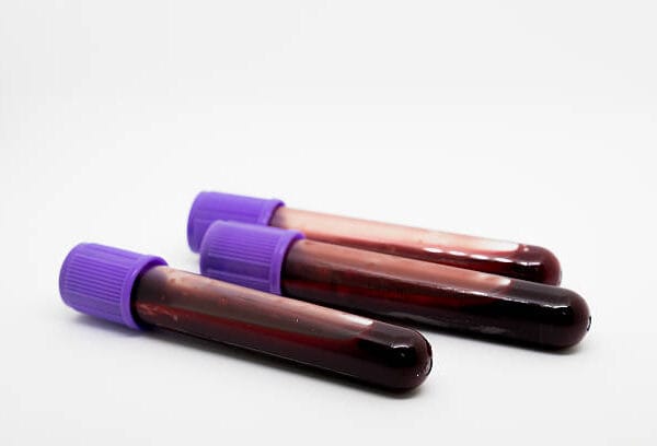Biochemazone™’s Artificial Blood Test Soil with Bone (BZ480)