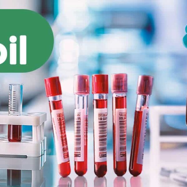 Artificial Test Soil