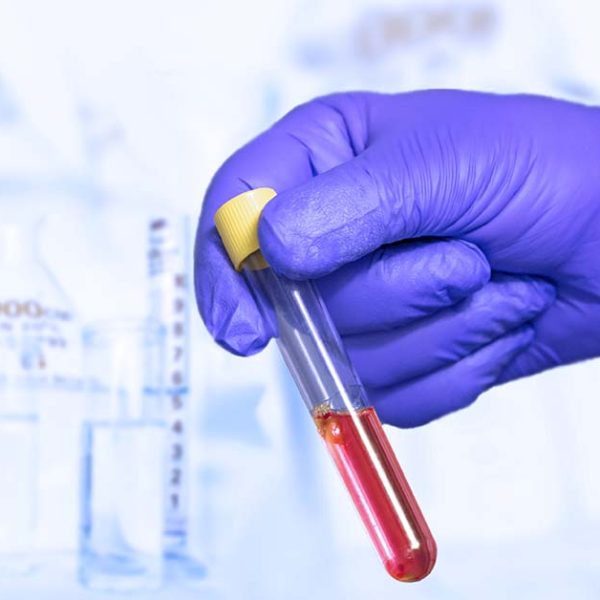 Artificial Test Soil ASTM F3208-20 (BZ477)